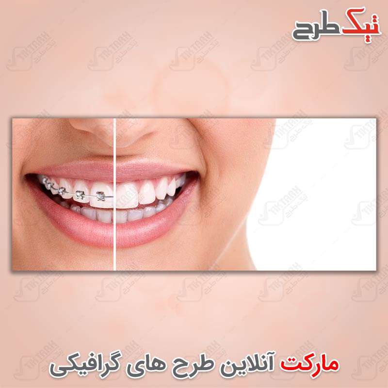 دانلود عکس با کیفیت ارتودنسی دندان