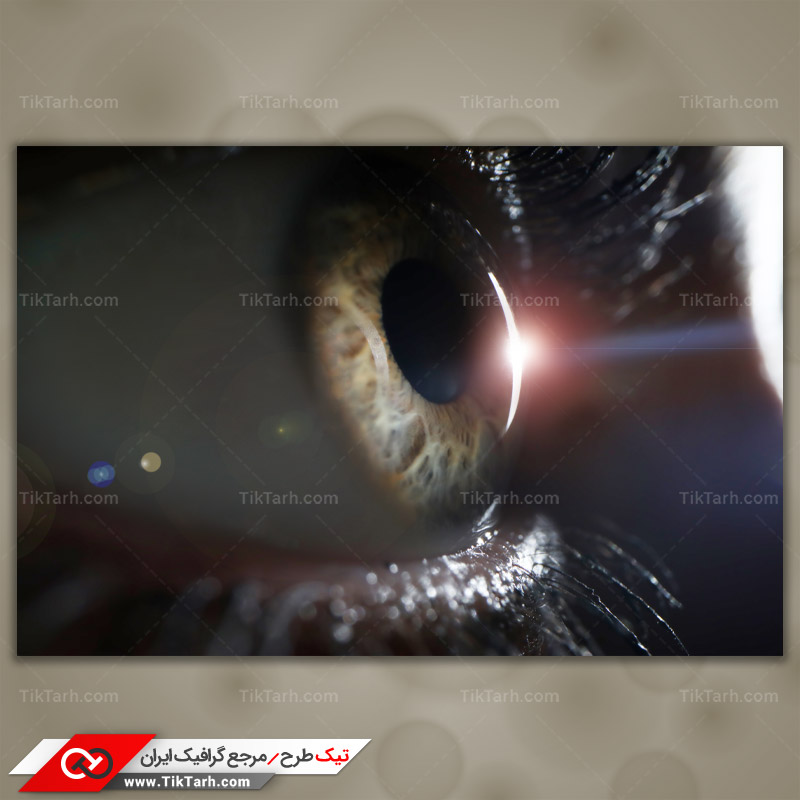 دانلود تصویر با کیفیت قرنیه چشم در حال اسکن